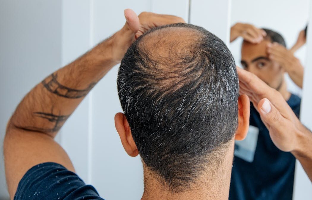 How does the hair-loss drug finasteride work? Can it affect my mental health?