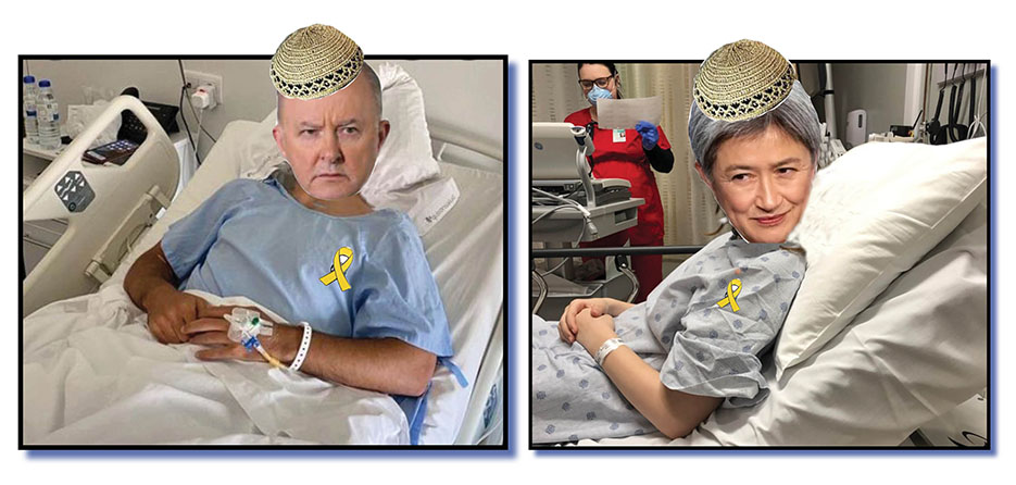 Cruel staff pranks lay low Albo, Penny!