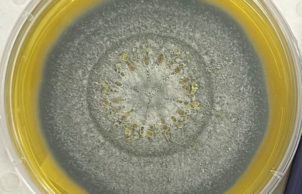 What is Aspergillus, the fungus behind recent hospital deaths?