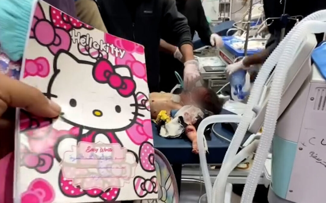 Doctors try to save girl as father was killed in Gaza Israeli attack