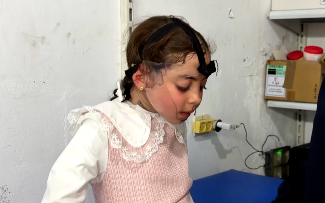 Burn treatment for Gaza children threatened by Israeli restrictions