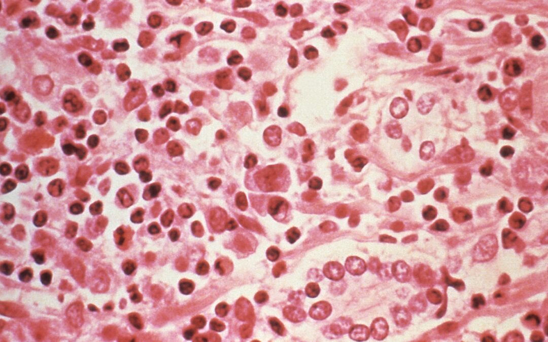 Three dead in suspected hantavirus outbreak on Atlantic cruise ship
